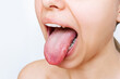 Cropped shot of a young woman showing tongue with a white plaque isolated on a white background. Digestive tract disease, organ dysfunction, poor oral hygiene, fungal infections