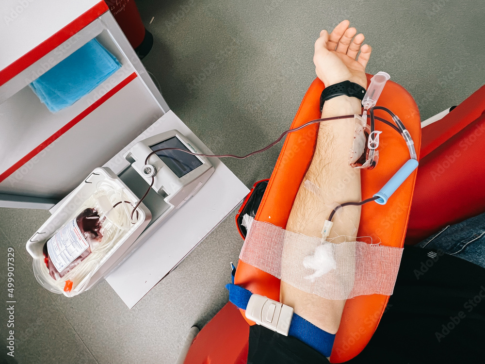 blood donation process from a donor at a blood transfusion center in Vinnytsia, Ukraine. Blood for the wounded of Russia's military action against the Ukrainian people