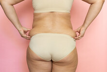 Woman With Thick Legs And Buttocks Closeup, Pinch Sagging Folds On Back, Fat And Cellulite. Naked Overweight Plus Size Girl On Pink Background In Beige Underwear. Concept Of Dieting And Body Control.