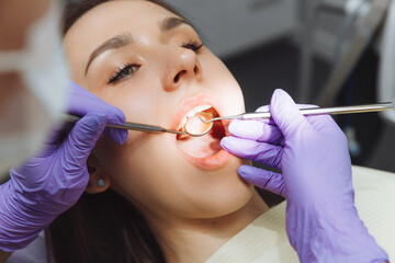 The dentist examines the teeth of a female patient, close-up. modern dentistry