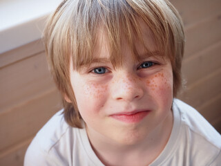 Wall Mural - closeup portrait of teenage boy face with freckles