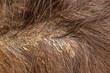 Close up of a head of a woman with psoriasis or dandruff in the hair