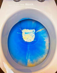 Closeup of toilet bowl seat with blue white environmantal harmful chemical chlorine aggressive cleaning detergent product