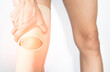 © yongyut - Muscle that are injured in the leg and knee.