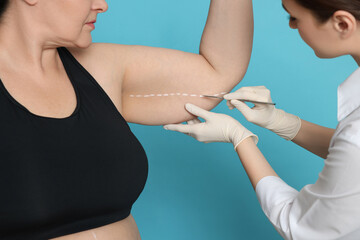 Wall Mural - Doctor with scalpel near obese woman on light blue background, closeup. Weight loss surgery