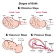 Stages of baby birth infographic diagram onset of labour flexion internal rotation of head extension then external rotation of head uterus immediately after birth vector illustration medical science