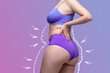 Leinwandbild Motiv Buttocks, hip, abdomen liposuction, fat and cellulite removal concept, overweight female body with painted surgical lines and arrows