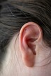 A sideways portrait of the ear of a woman with acupressure ear seeds in it. The three metal balls are a form of alternative medicine, which would relieve stress, tention and would help relax and heal.