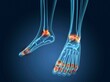 © SuperStock - X-ray view of inflamed foot bones