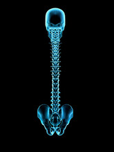 X-Ray Of Human Hip And Skull, Digitally Generated Image By Hank Grebe