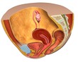 © SuperStock - Female reproductive system, medical illustration