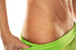 © vladimirfloyd - skin indents from underwear on a woman's hips. closeup