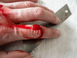 © ludmila - Close-up of a hand cut with red blood. macro