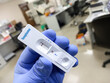 © MdBabul - Rapid test kit for Toxoplasma test, show positive result, rapid test cassette.