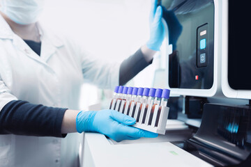Wall Mural - medical blood tests on automatic modern equipment of laboratories