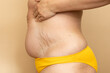 © Юля Бурмистрова - Woman in yellow swimsuit draw in thick belly with stretch marks using hands closeup, beige background. Slimming, fighting overweight, obesity and cellulite. Plus size people and body positive concept.