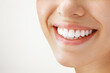 © Aleksandr Rybalko - Beautiful female smile after teeth whitening procedure. Dental care. Dentistry concept.