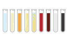 Vector Illustration Of A Test Tube Containing Urine.