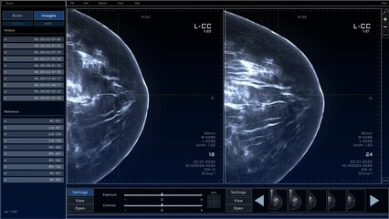 Aufkleber - Mammogram Breast Scan Mock-up with Multiple Windows and Data. Medical Research Environment Software with X-Ray Scan Results for Computer Displays and Laptop Screens.