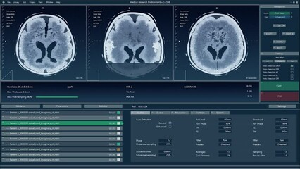 Aufkleber - Magnetic Resonance Imaging Brain Scan Mock-up with Multiple Windows and Data. Medical Research Environment Software with MRI Results for Computer Displays and Laptop Screens.