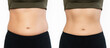 Two shots of a woman's belly with excess fat and toned slim stomach with abs before and after losing weight isolated on a white background. Result of diet, liposuction, sports. Healthy lifestyle