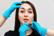 © _KUBE_ - Portrait of a pretty young woman with surgical marks on her face. Cosmetologists' hands in rubber gloves, pulling a woman's face. The concept of plastic surgery and rejuvenation