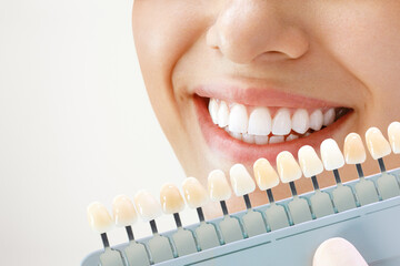 Smiling young woman. Cosmetological teeth whitening in a dental clinic. selection of the tone of the implant tooth