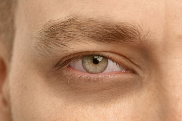 Tired man with dark circle under eye, closeup