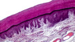 Human skin. Light micrograph of epithelial tissue from the skin. Human finger section showing epidermis (stratified squamous epithelium), dermis and connective tissues.  H&E stain.