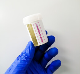 Poster - Urine sample for 24 hours urine creatinine.