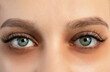 canvas print picture Tired young woman with dark circles under eyes, closeup