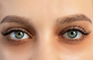 Tired young woman with dark circles under eyes, closeup