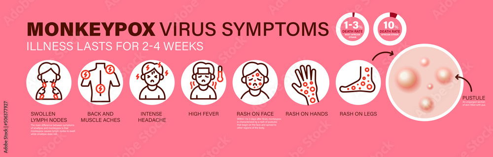 Monkeypox virus Symptoms. New cases of Monkeypox virus are reported in ...