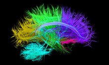 Human Brain Nerve Tracts, Illustration