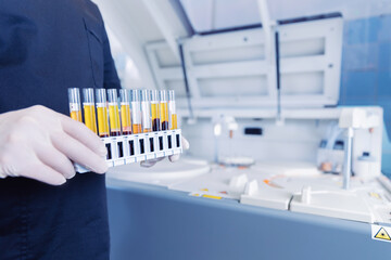 Wall Mural - medical blood tests on automatic modern equipment of laboratories