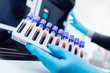 Wall Mural - macro photo hand of medical worker, biochemical analyzer blood tests on modern equipment of laborato