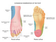 Medical illustration of  the cutaneous innervation of the foot, with annotations.