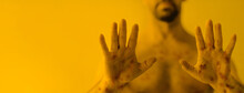 Male Hands Affected By Blistering Rash Because Of Monkeypox Or Other Viral Infection On Yellow Background, Wide Banner.