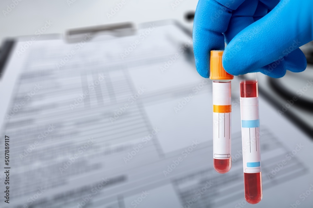 Blood sample tube for analysis of test in the laboratory. doctor ...