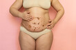 © Юля Бурмистрова - Cropped of overweight fat woman holding tummy, flabs with obesity, excess fat in underwear, applying moisturizer cream. Anti-cellulite cream cosmetics, scrubs. Cellulite treatment. Fast weight loss