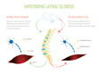 

Infographic about the functioning of the orders from the brain to the muscles with and without amyotrophic lateral sclerosis.
