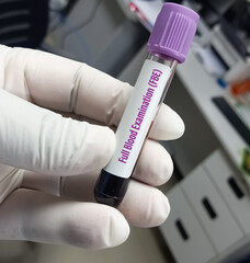 Poster - Test tube with blood sample for Full blood examination(FBE) test, Complete Blood Count, CBC test.