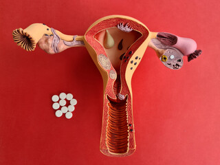 Poster - Uterus and medical pills on red background