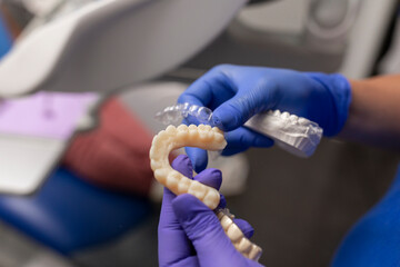 Detail of a dentist's hands, wearing blue gloves, showing a patient's plaster teeth molds and a dental splint, at the dental clinic