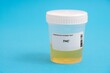 THC. THC toxicology screen urine tests for doping and drugs