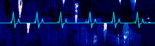 Wide Format Heartbeat Pulse Blip With Ink Textures