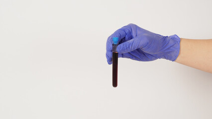 The hand is holding blood test tubes on white background. Hand wears a purple medical glove..