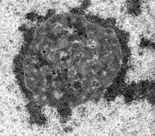 Nucleolus. TEM Micrograph