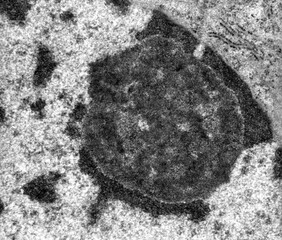 Sticker - Nucleolus. TEM micrograph