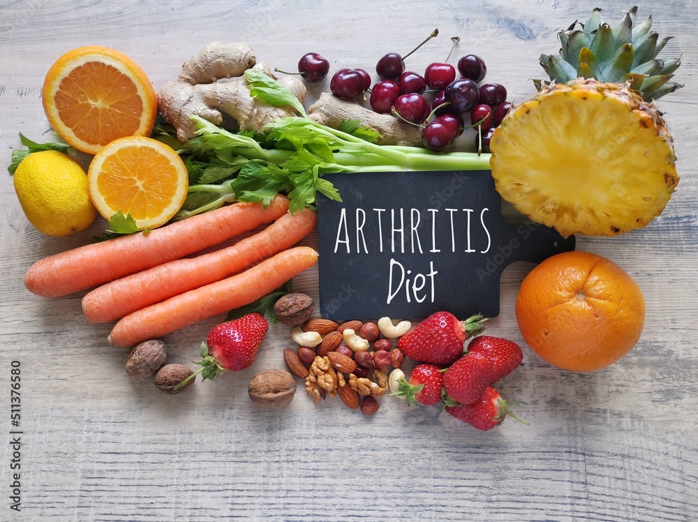 Healthy foods to help arthritis pain. Assortment of fresh fruit and ...